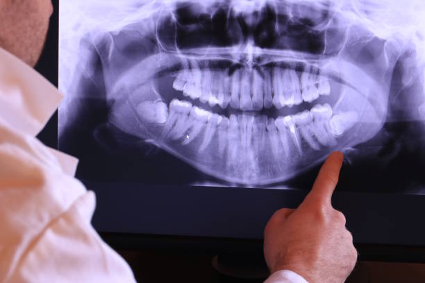 Best Emergency Dental Care for Broken or Chipped Teeth in Farwell, TX